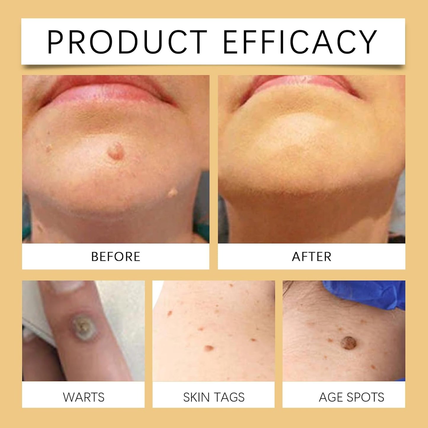 Bee Venom Skin Treatment Cream: Advanced Firming & Wrinkle-Reducing Bee Venom Repair Cream